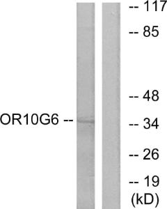 Western blot analysis of lysates from COLO cells using Anti-OR10G6 Antibody. The right hand lane represents a negative control, where the antibody is blocked by the immunising peptide