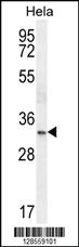 Anti-NKX2-1 Rabbit Polyclonal Antibody