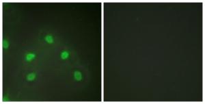 Immunofluorescence analysis of HeLa cells using Anti-hnRNP L Antibody The right hand panel represents a negative control, where the antibody was pre-incubated with the immunising peptide