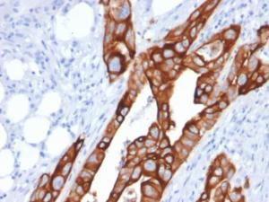 Anti-Cytokeratin 20 Mouse Monoclonal Antibody [clone: KRT20/1991]