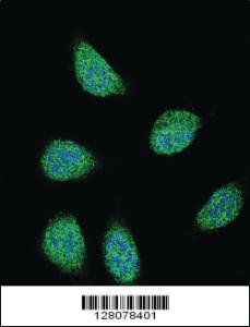 Anti-SERPINA6 Rabbit Polyclonal Antibody