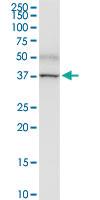 Anti-PNMA1 Rabbit Polyclonal Antibody