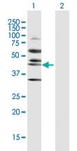 Anti-RRS1 Rabbit Polyclonal Antibody