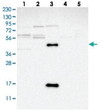 Anti-C17ORF53 Rabbit Polyclonal Antibody