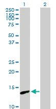 Anti-PNCK Mouse Polyclonal Antibody