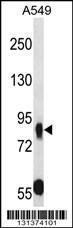 Anti-CDHR5 Rabbit Polyclonal Antibody