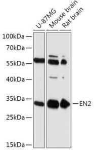 Western blot analysis of extracts of various cell lines, using Anti-EN2 Antibody (A305319) at 1:1,000 dilution