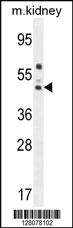 Anti-SERPINA6 Rabbit Polyclonal Antibody