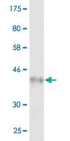 Anti-CD74 Mouse Monoclonal Antibody [clone: 1D1]