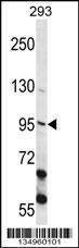 Anti-ECT2 Rabbit Polyclonal Antibody (Biotin)