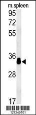 Anti-MURC Rabbit Polyclonal Antibody (AP (Alkaline Phosphatase))