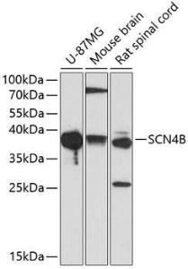 Antibody anti-SCN4B 100 µl