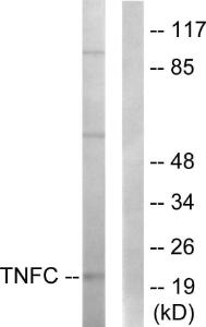 Western blot analysis of lysates from HepG2 cells using Anti-TNFC Antibody. The right hand lane represents a negative control, where the antibody is blocked by the immunising peptide