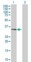 Anti-SDSL Mouse Polyclonal Antibody