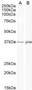 Anti-DLX2 Antibody (A85134) (1 µg/ml) staining of Human Cerebellum (A) and Rat (B) Brain lysate (35 µg protein in RIPA buffer). Primary incubation was 1 hour. Detected by chemiluminescence