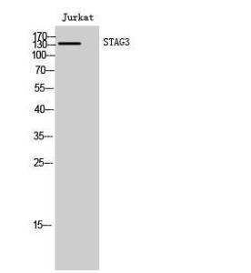 Western blot analysis of Jurkat cells using Anti-STAG3 Antibody