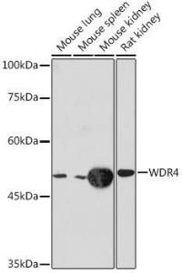 Western blot analysis of extracts of various cell lines, using Anti-WDR4 Antibody [ARC2292] (A305320) at 1:1,000 dilution. The secondary antibody was Goat Anti-Rabbit IgG H&L Antibody (HRP) at 1:10,000 dilution.