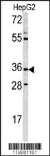 Anti-CD38 Rabbit Polyclonal Antibody