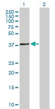 Anti-ACTRT1 Mouse Polyclonal Antibody