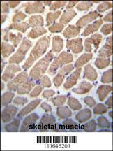 Anti-TSC1 Rabbit Polyclonal Antibody (FITC (Fluorescein Isothiocyanate))