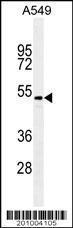 Anti-TGFB2 Mouse Monoclonal Antibody (HRP (Horseradish Peroxidase)) [clone: 220ct16.4.3.1]