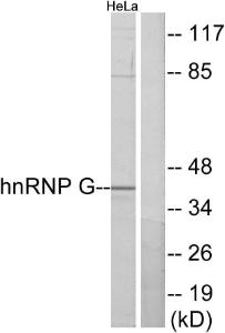 Western blot analysis of lysates from HeLa cells using Anti-hnRNP G Antibody. The right hand lane represents a negative control, where the antibody is blocked by the immunising peptide