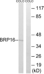 Western blot analysis of lysates from COLO cells using Anti-BRP16 Antibody. The right hand lane represents a negative control, where the antibody is blocked by the immunising peptide