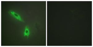 Immunofluorescence analysis of HeLa cells using Anti-TNFC Antibody. The right hand panel represents a negative control, where the antibody was pre-incubated with the immunising peptide