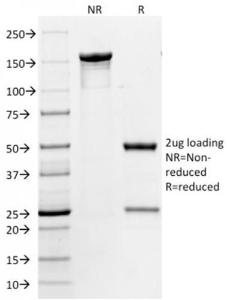 SDS-PAGE analysis of Anti-CD31 Antibody [158-2B3] under non-reduced and reduced conditions; showing intact IgG and intact heavy and light chains, respectively. SDS-PAGE analysis confirms the integrity and purity of the antibody.