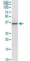 Anti-PNMA1 Rabbit Polyclonal Antibody