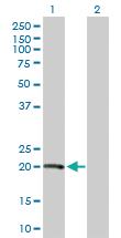 Anti-VHL Mouse Polyclonal Antibody