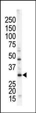 Anti-STK16 Rabbit Polyclonal Antibody (Biotin)