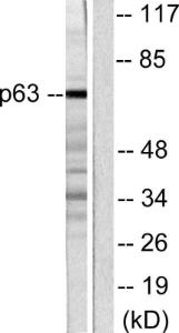 Antibody anti-P63 100 µg