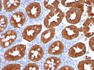 Anti-Cytokeratin 20 Mouse Monoclonal Antibody [clone: KRT20/1991]