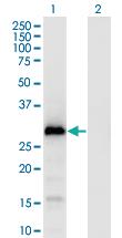 Anti-GAGE1 Mouse Monoclonal Antibody [clone: 4G6]