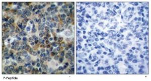 Anti-VASP Rabbit Polyclonal Antibody