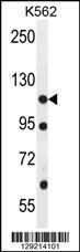 Anti-ECT2L Rabbit Polyclonal Antibody (AP (Alkaline Phosphatase))