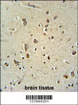 Anti-CARNS1 Rabbit Polyclonal Antibody (FITC (Fluorescein Isothiocyanate))