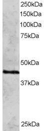 Anti-RAD51C Antibody (A83469) staining (2 µg/ml) of HeLa lysate (RIPA buffer, 30µg total protein per lane). Primary incubated for 12 hour. Detected by western blot using chemilu minescence