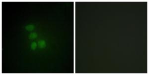 Immunofluorescence analysis of HepG2 cells using Anti-hnRNP G Antibody. The right hand panel represents a negative control, where the antibody was pre-incubated with the immunising peptide