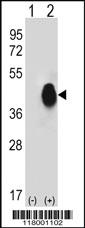 Anti-CD38 Rabbit Polyclonal Antibody