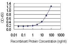 Anti-GAGE1 Mouse Monoclonal Antibody [clone: 4G6]