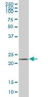 Anti-VHL Mouse Polyclonal Antibody