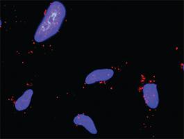 Anti-HSPA1L + RELA Antibody Pair