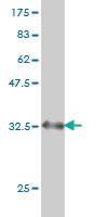 Anti-BDKRB2 Mouse Monoclonal Antibody [clone: 3F6]