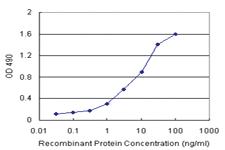 Anti-GSTP1 Antibody Pair