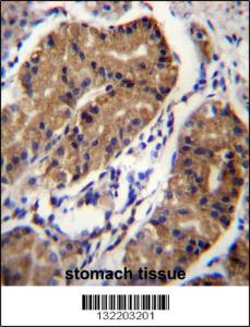 Anti-DCC Rabbit Polyclonal Antibody (AP (Alkaline Phosphatase))