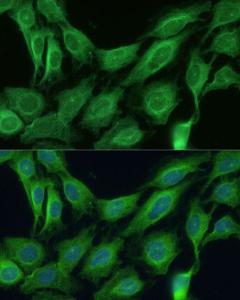 Immunofluorescence analysis of C6 cells using Anti-CNNM1 Antibody (A93198) at a dilution of 1:100 DAPI was used to stain the cell nuclei (blue)