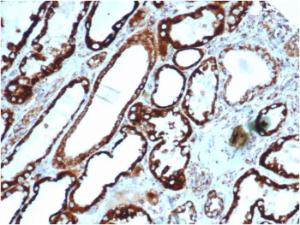 Immunohistochemical analysis of formalin-fixed, paraffin-embedded human thyroid using Anti-HSP60 Antibody [rHSPD1/6495]