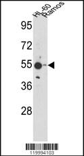 Anti-ENOA Rabbit Polyclonal Antibody